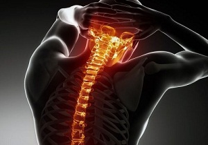 rules for the treatment of cervical spine osteochondrosis