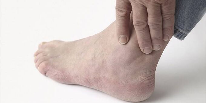 ankle arthrosis pain