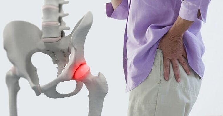 pain in the hip region - a symptom of arthrosis of the hip joint