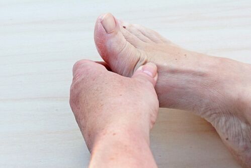 foot arthrosis